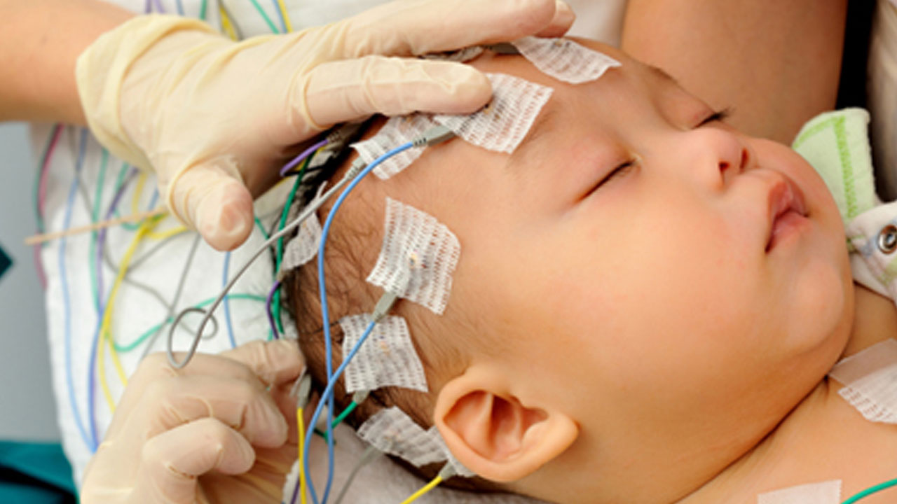 ESDM Therapy for Autism