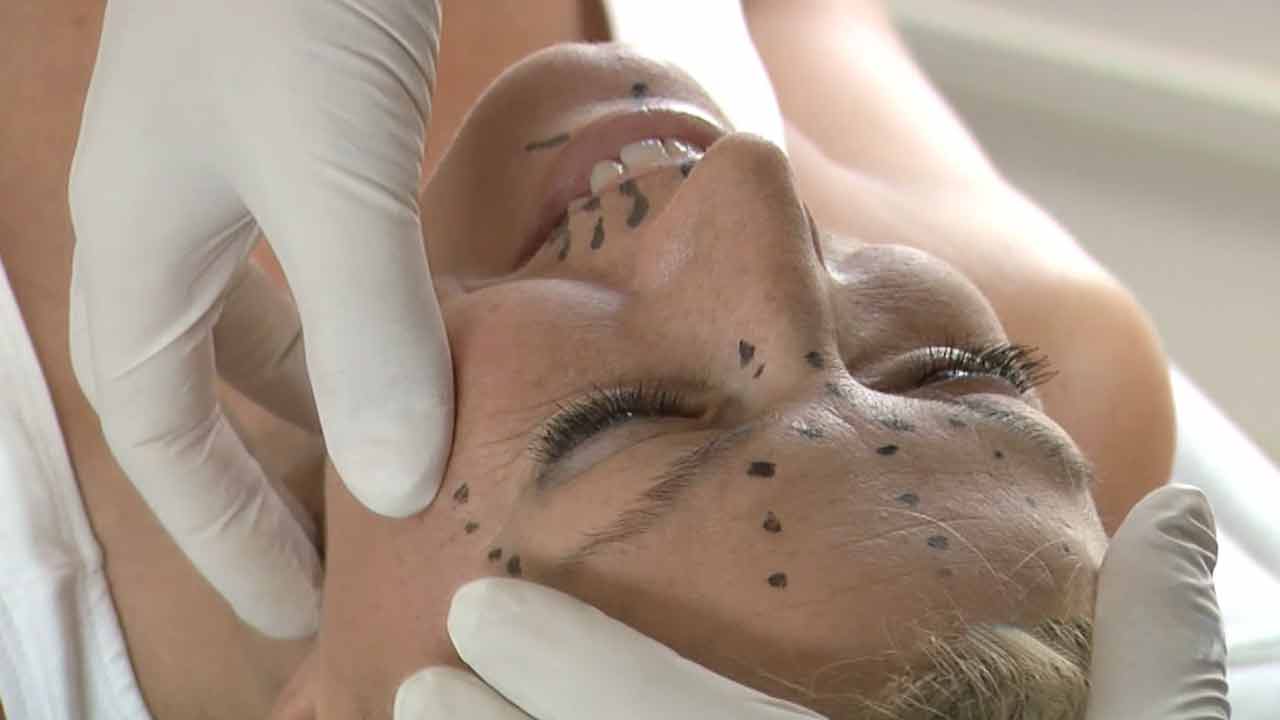 plastic surgery results